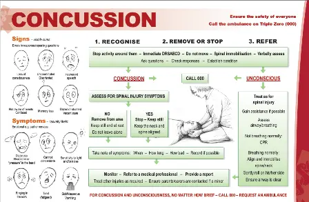 Chart concussion